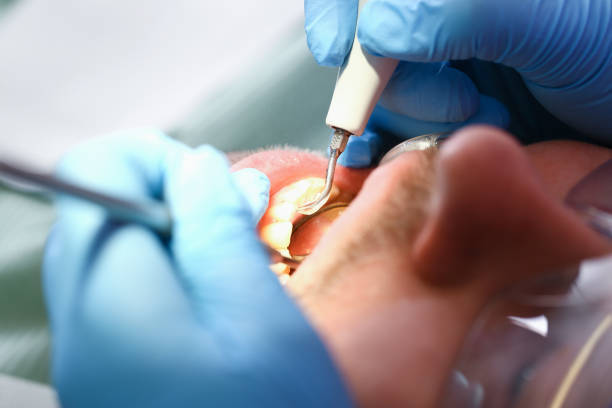 Best Emergency Gum Pain Relief  in Hawkinsville, GA